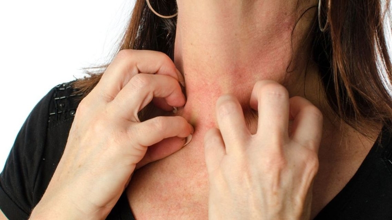 Điều trị nguyên nhân và kiểm soát ngứa giúp cải thiện chất lượng cuộc sống