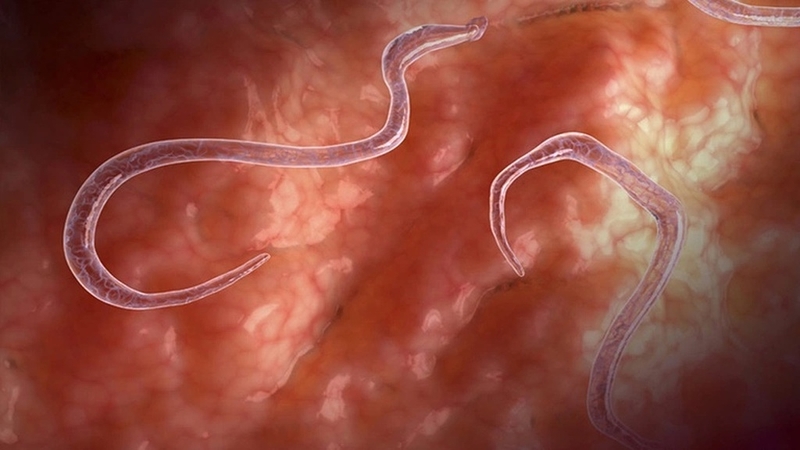 Ngứa hậu môn có phải bị giun không? 4