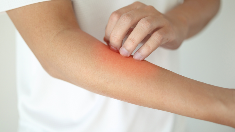 Các bệnh lý về da thường là nguyên nhân hàng đầu gây ngứa rát