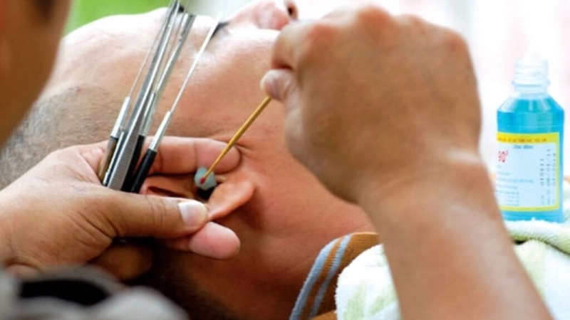 Ngứa tai phải - Nguyên nhân và cách điều trị hiệu quả 2