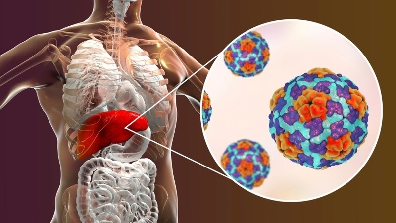 Người bị bệnh viêm gan B có nguy hiểm không? 3