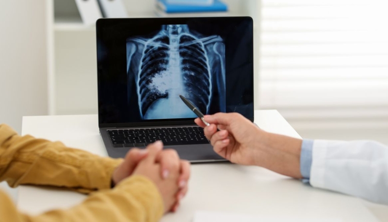 Người bị lao phổi nên ăn gì và kiêng gì? Lời khuyên từ bác sĩ 4