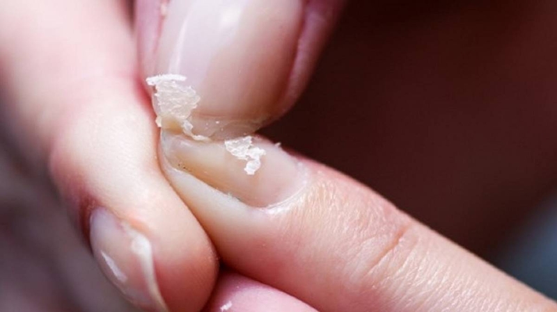 Người bị thiếu canxi nên ăn gì là tốt nhất 1