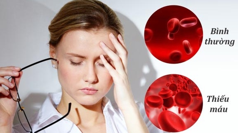 Người bị thiếu máu nên bổ sung những loại thực phẩm nào? 1