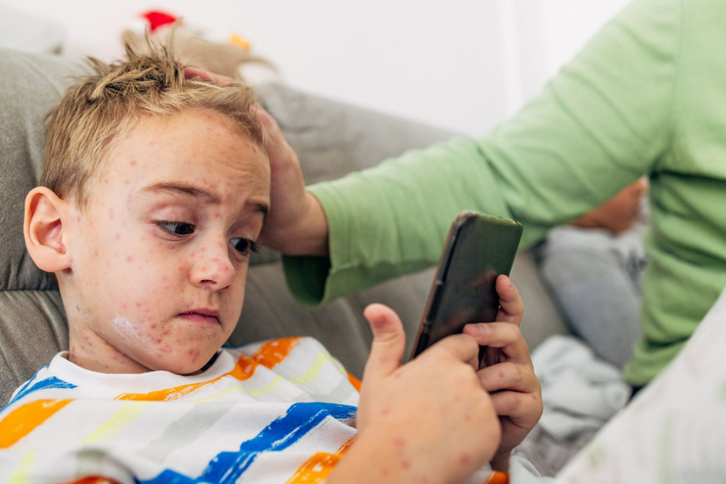 Người bị thủy đậu có được dùng sữa rửa mặt không?1