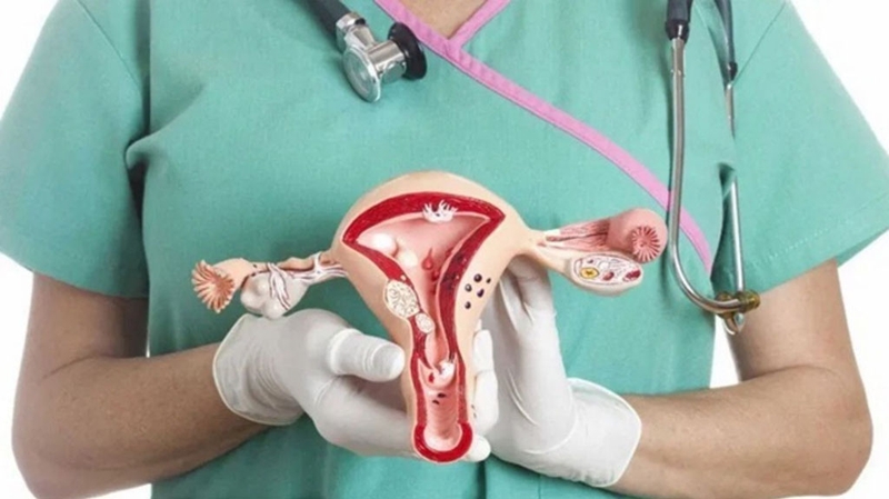 Người bị u xơ tử cung có được ăn lạc không? 1