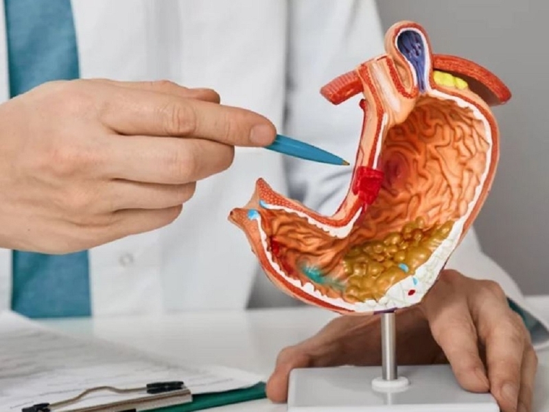 Người bị xuất huyết dạ dày nên ăn gì và không nên ăn những gì? 2