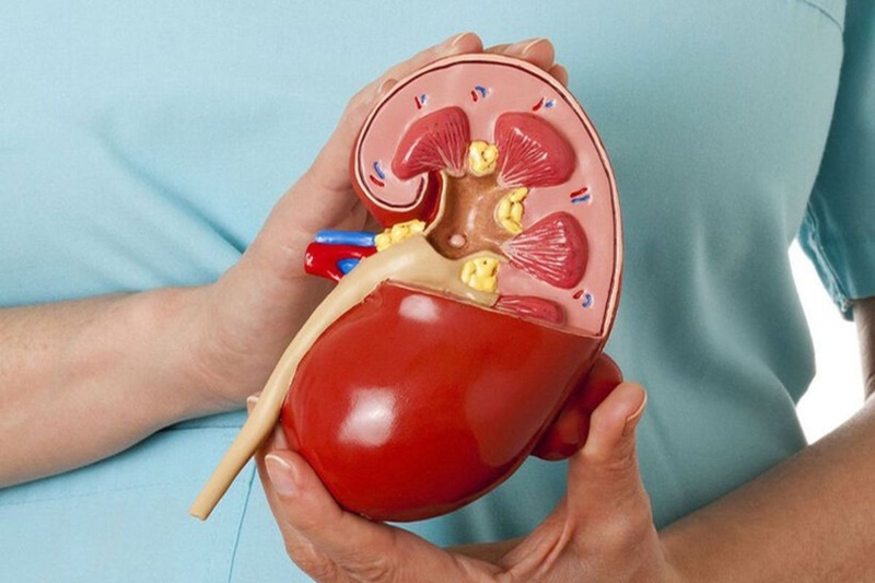 Người cho thận sống được bao lâu? Cách duy trì sức khỏe khi còn một bên thận 2