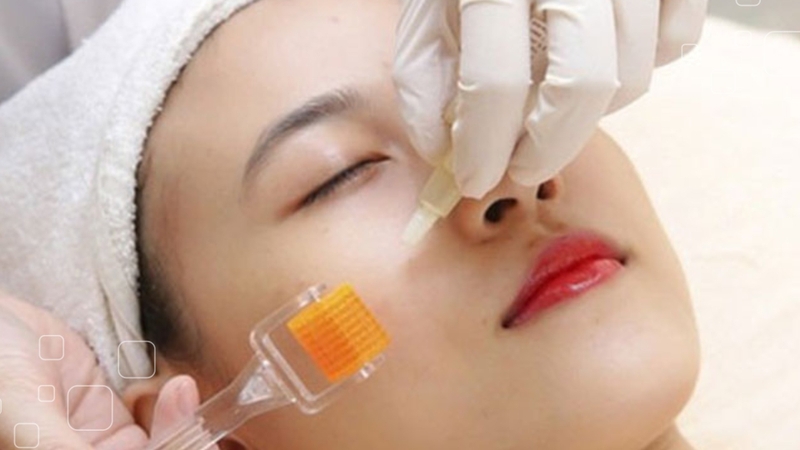 Người có làn da mỏng yếu có lăn kim được không?-1