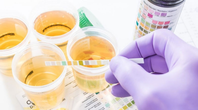 Người có một quả thận bẩm sinh có sống được không? Những điều cần chú ý 4