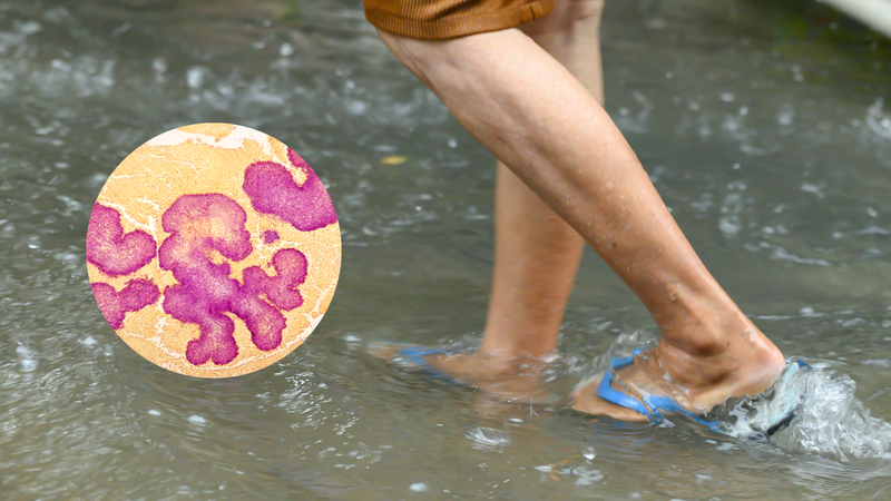 Nhiễm xoắn khuẩn vàng da là căn bệnh nguy hiểm cần cảnh giác