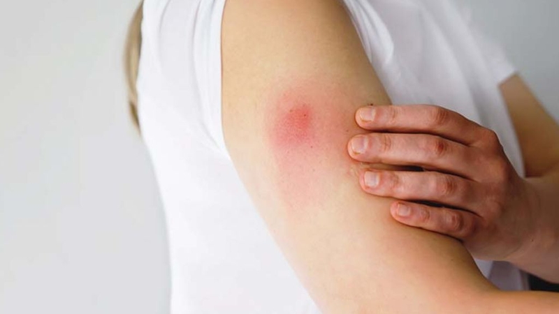 Tại sao bác sĩ đề nghị mọi người nên tiêm vắc xin ngừa cúm mỗi năm? 3