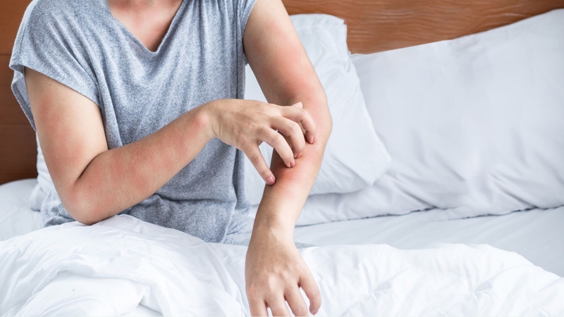 Dị ứng chính là nguy cơ từ rượu sáp ong ngâm