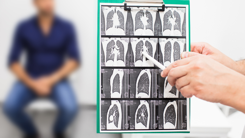 nguy-kich-la-gi-hoi-chung-nguy-kich-ho-hap-va-benh-sinh 3