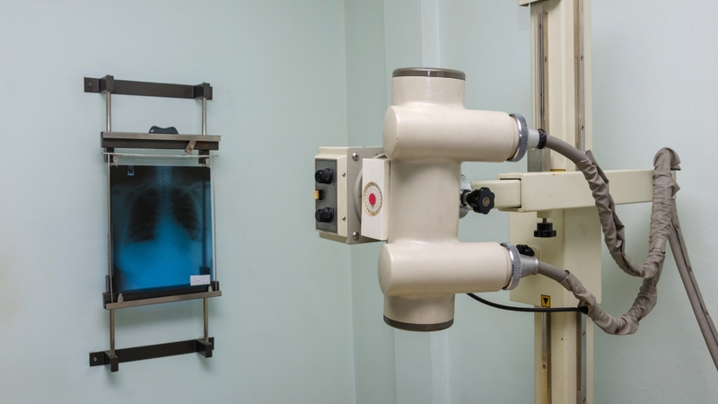 Nguyên lý chụp X-quang và một số điều cần biết 1