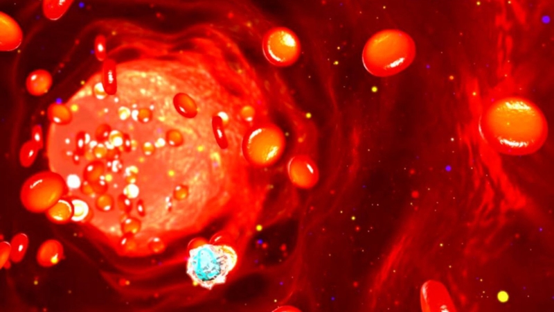 Nguyên lý siêu âm Doppler mạch: Cơ sở vật lý và ứng dụng lâm sàng 3