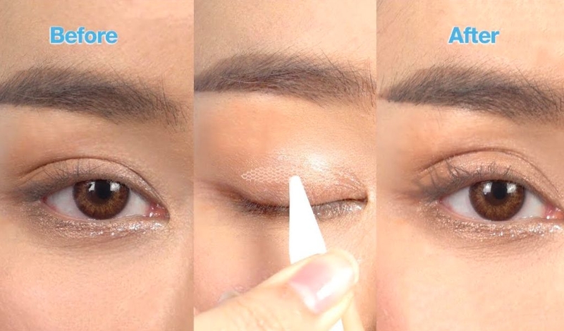 Nguyên nhân 2 mí mắt không đều? Cách làm 2 mí mắt đều nhau tại nhà? 2