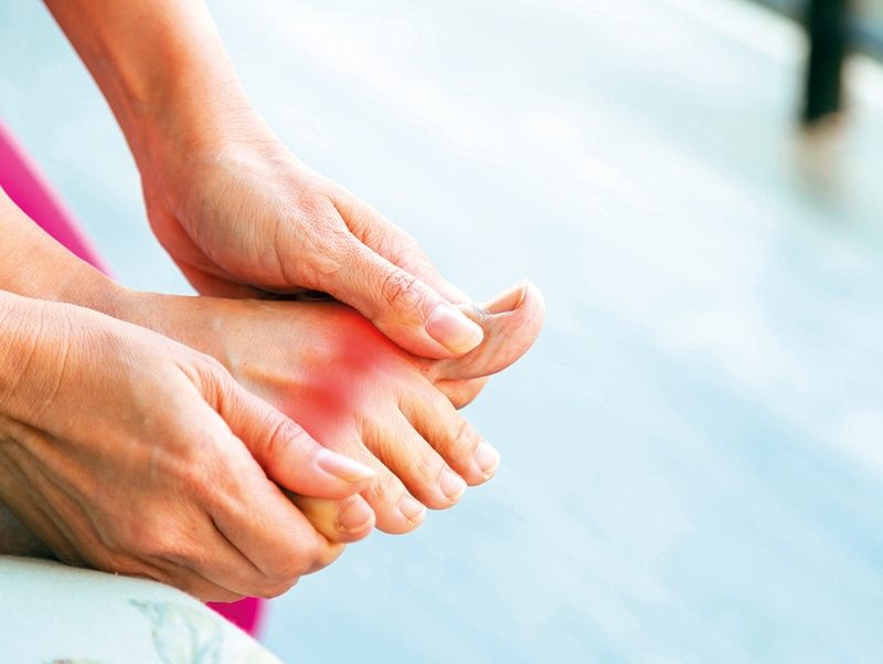 Nguyên nhân bệnh gout và cách nhận biết bệnh 1