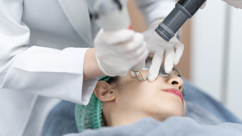 Laser là một trong những phương pháp có thể được cân nhắc đối với một số trường hợp nám