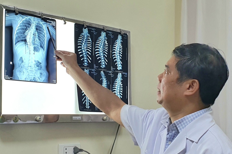 Đâu là nguyên nhân chủ yếu gây cong vẹo cột sống? -3