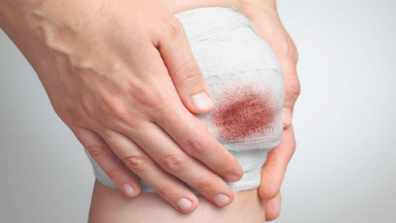 Nguyên nhân đây MSSA là gì? Các loại nhiễm trùng MSSA 2