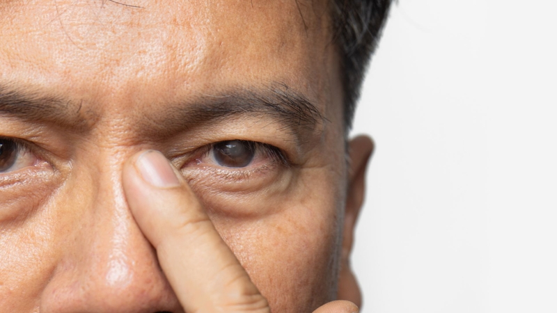 Một trong những nguyên nhân đục thủy tinh thể là do sự suy giảm chuyển hóa