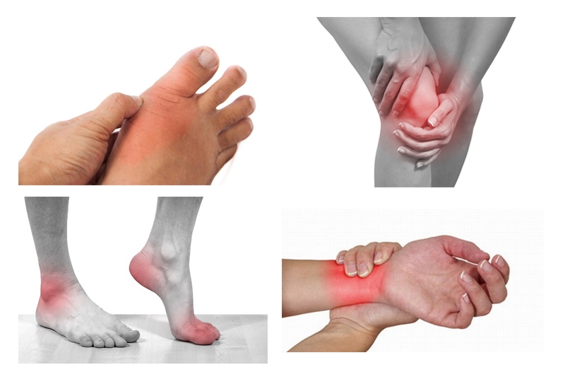 Điểm mặt 3 nguyên nhân gai cột sống và những biểu hiện thường gặp 3