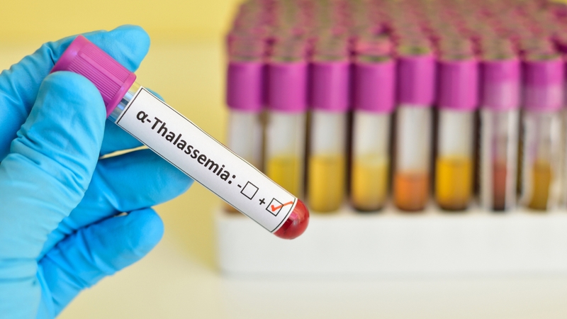 Nguyên nhân gây bệnh alpha Thalassemia và cách phòng ngừa hiệu quả 0