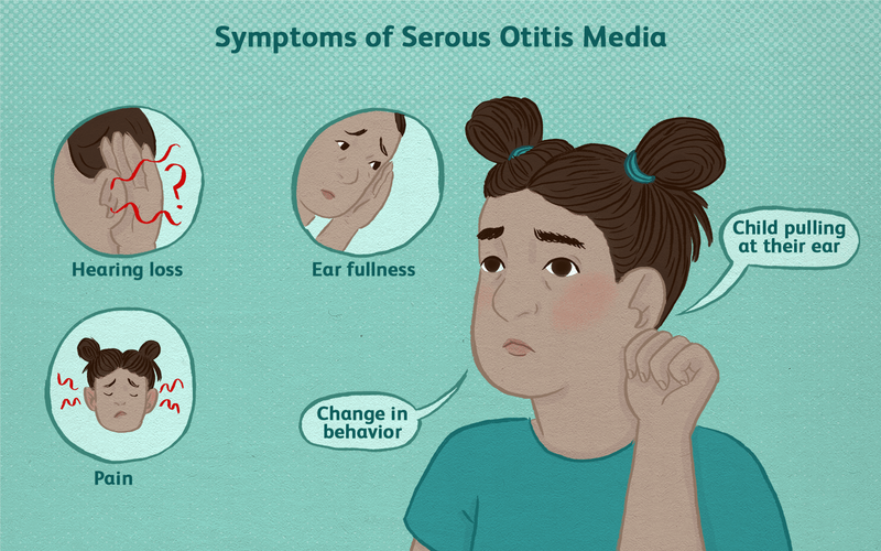 Nguyên nhân gây bệnh viêm tai giữa thanh dịch? Có chữa được không? 3