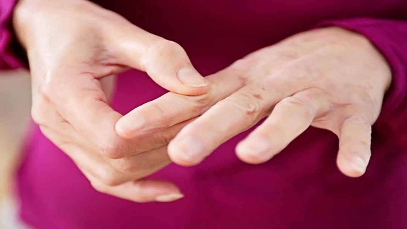 Nguyên nhân gây đau khớp ngón tay và cách điều trị 1