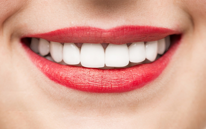 Nguyên nhân gây ê buốt sau khi tẩy trắng răng và cách giảm ê buốt 1