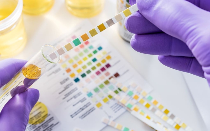 Nguyên nhân gây hiện tượng đái ra dưỡng chấp và cách xử trí tình trạng này bạn nên biết 1