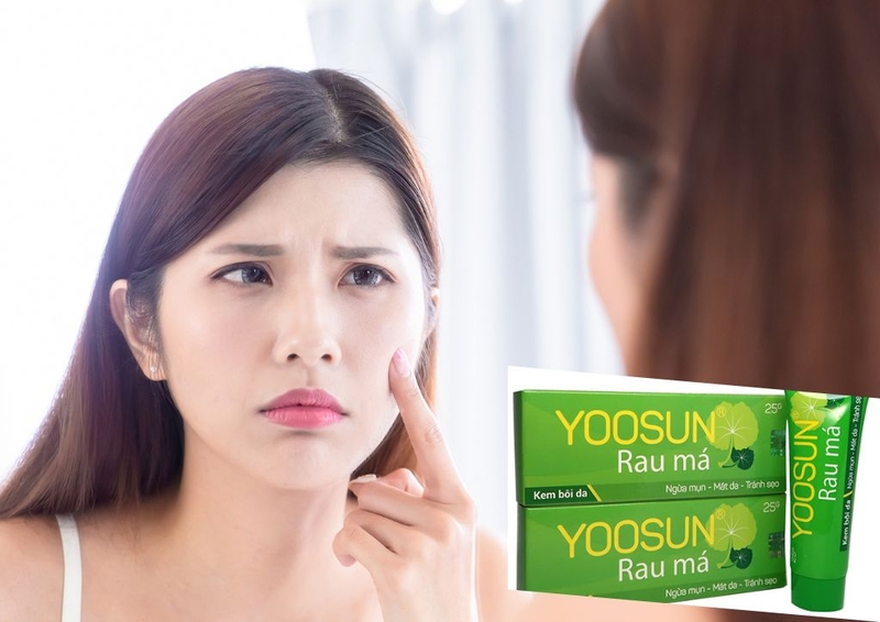 Nguyên nhân gây mụn đầu đen? Yoosun rau má có trị mụn đầu đen không?  3