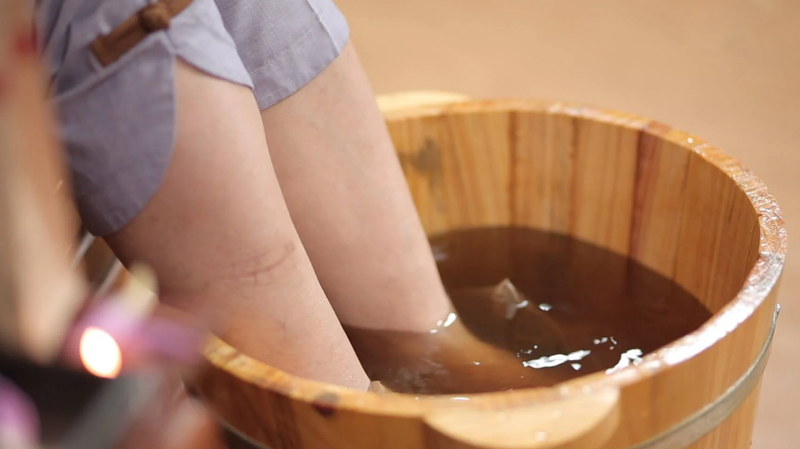 Nguyên nhân gây nứt gót chân và các biện pháp phòng ngừa 3