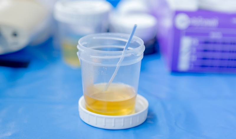 Nguyên nhân gây protein niệu khi mang thai2