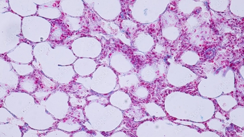 nguyen-nhan-gay-ra-ton-thuong-te-bao 3.jpg