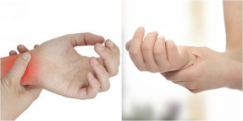 Nguyên nhân gây tê yếu tay chân ở người trẻ 2