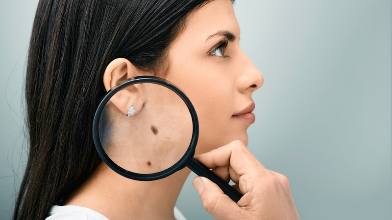 Nguyên nhân gây thay đổi màu sắc da là gì? Thay đổi màu sắc da có nguy hiểm không? 3