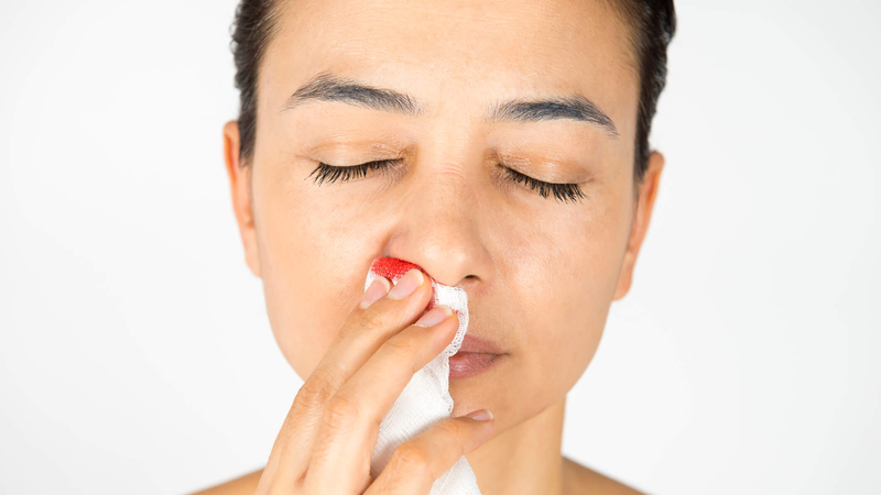 nguyen-nhan-gay-tinh-trang-chay-mau-cam-la-gi 2.jpg