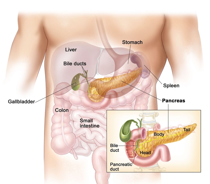 Nguyên nhân gây ung thư tuỵ1