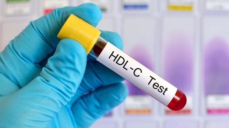 nguyen-nhan-hdl-cholesterol-thap-la-gi-nhung-dieu-can-biet 2
