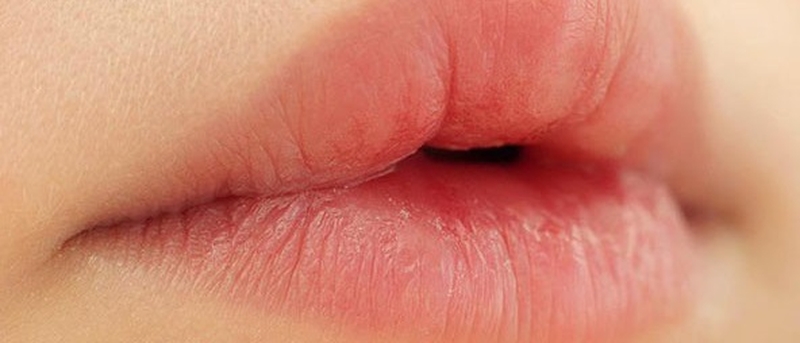 Lỡ ăn hải sản sau khi xăm môi có sao không? 2