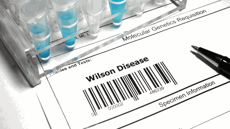 Nguyên nhân men gan cao là gì? Cách ngăn ngừa men gan cao 3