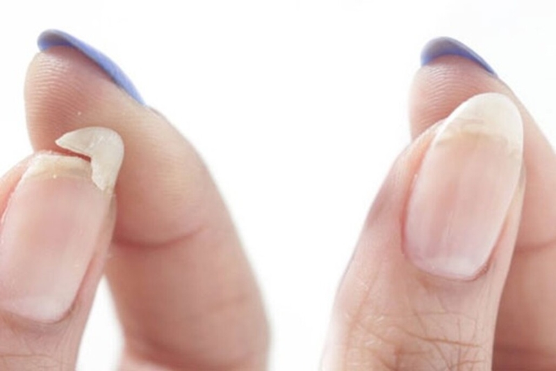 Nguyên nhân móng tay giòn, dễ gãy và cách cải thiện tình trạng này 3