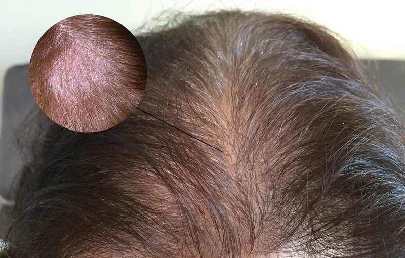 cach-lua-chon-dau-goi-tri-vay-nen-da-dau-6