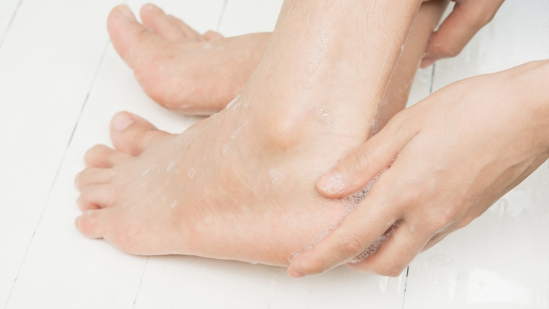 Nguyên nhân dẫn đến bàn chân lỗ rỗ 5