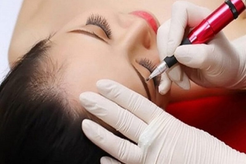 Nguyên nhân ngứa lông mày sau khi điêu khắc và cách xử lý 2