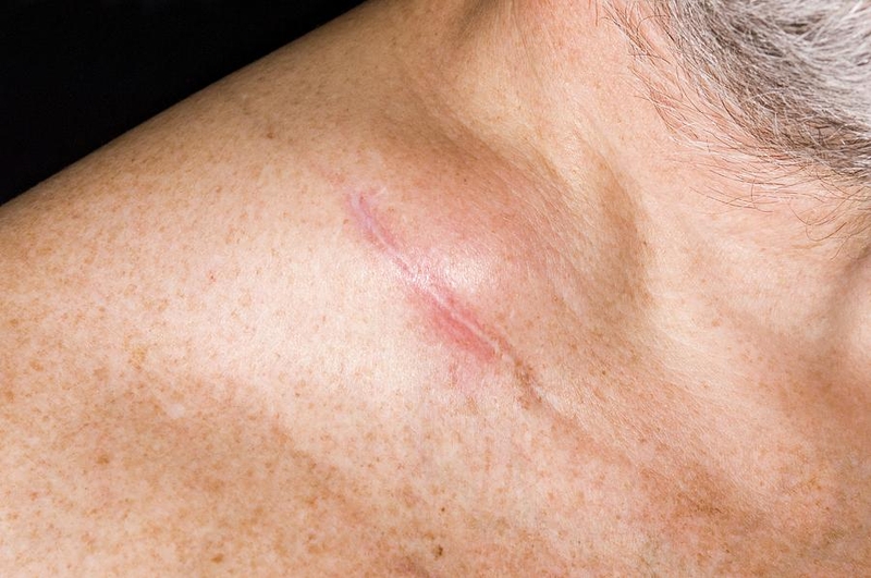 Nguyên nhân nổi hạch dưới cằm - Bạn đã biết chưa? 1