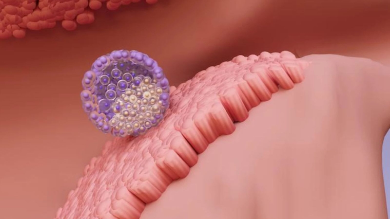 vi-sao-phoi-khong-bam-vao-tu-cung-nhung-dieu-can-biet 1