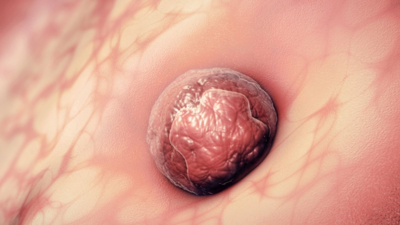 vi-sao-phoi-khong-bam-vao-tu-cung-nhung-dieu-can-biet 3